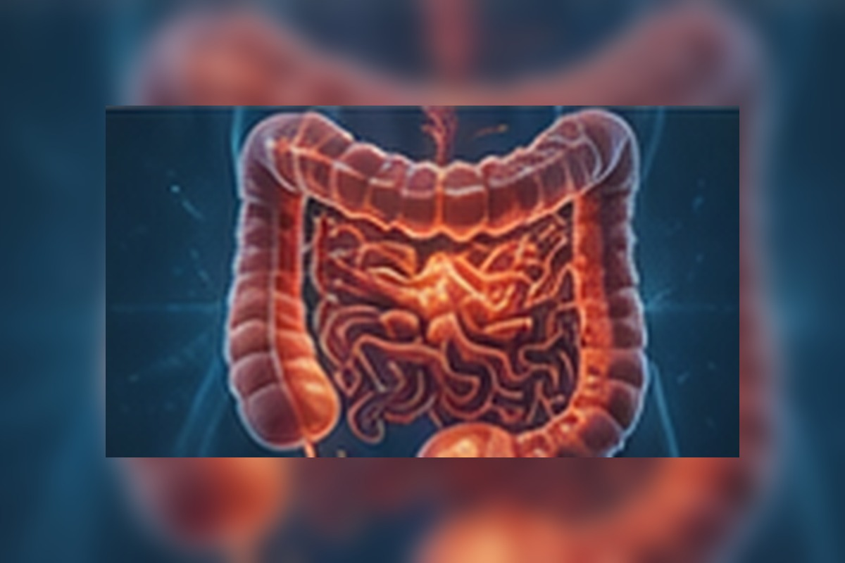 Medical-style visualization of the intestinal tract